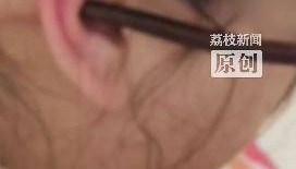 女子睡前没摘发簪，夜里插入耳朵直抵后脑勺！医生提醒