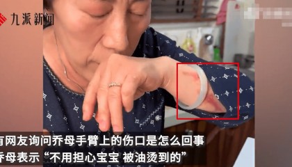 乔任梁母亲回应手臂伤口：被油烫到的