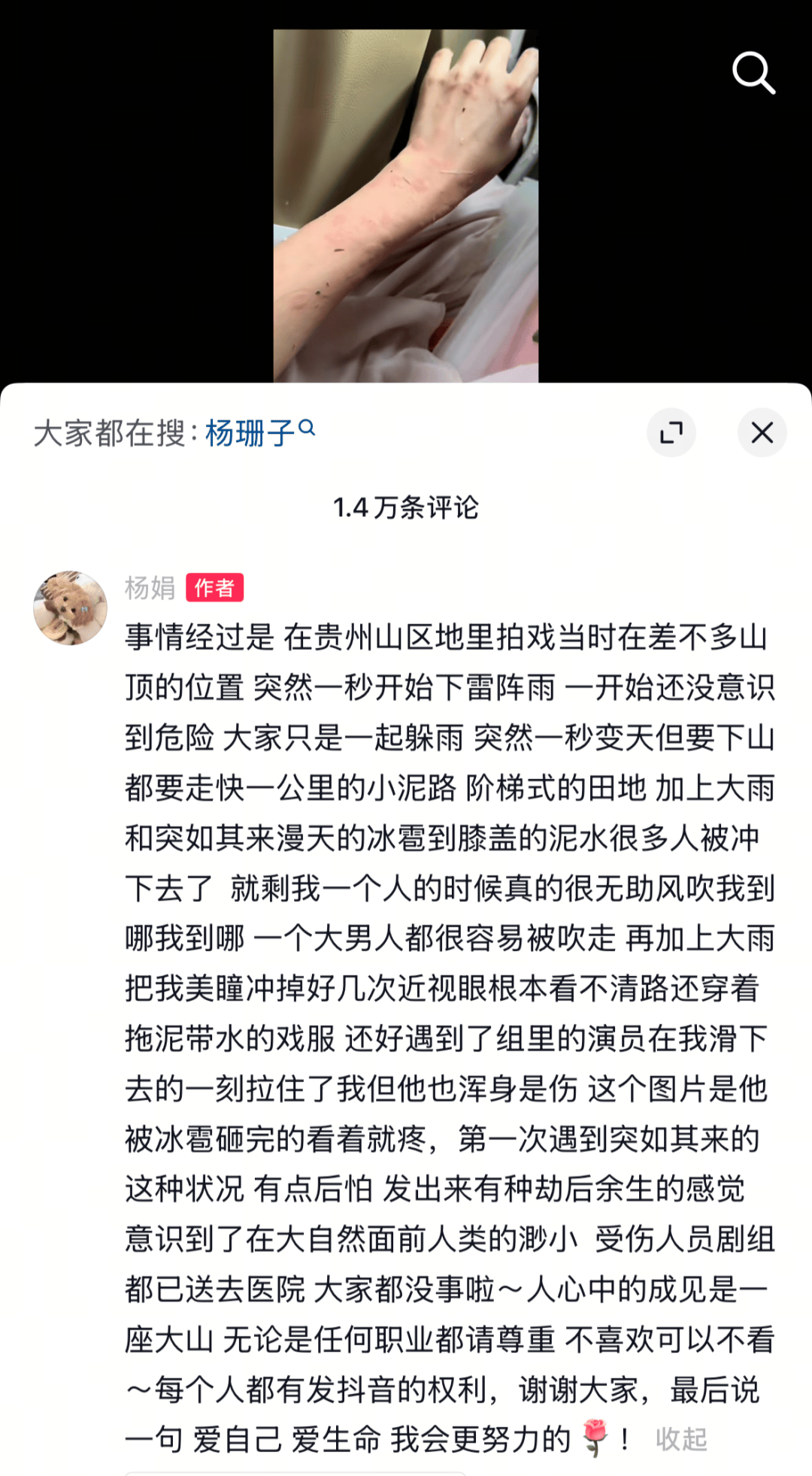 女演员杨珊子拍戏遇极端天气！胳膊被冰雹砸伤、美瞳被冲掉，剧组受伤人员已送医
